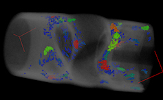 http://www.sematec-metrologie.com/wp-content/uploads/2013/10/porosites_pieces_plastiques_scan_par_tomographie_sematec_metrologie.png