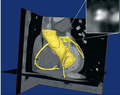 https://revistacontacto.uniandes.edu.co/images/stories/numero3/13-17software%20diagnostico%2024%20marzo_pagina_2.jpg