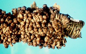 ../carcinoma%20colorrectal_archivos/ccr8.jpg