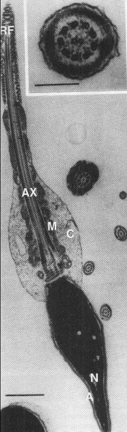 spermatozoid 1